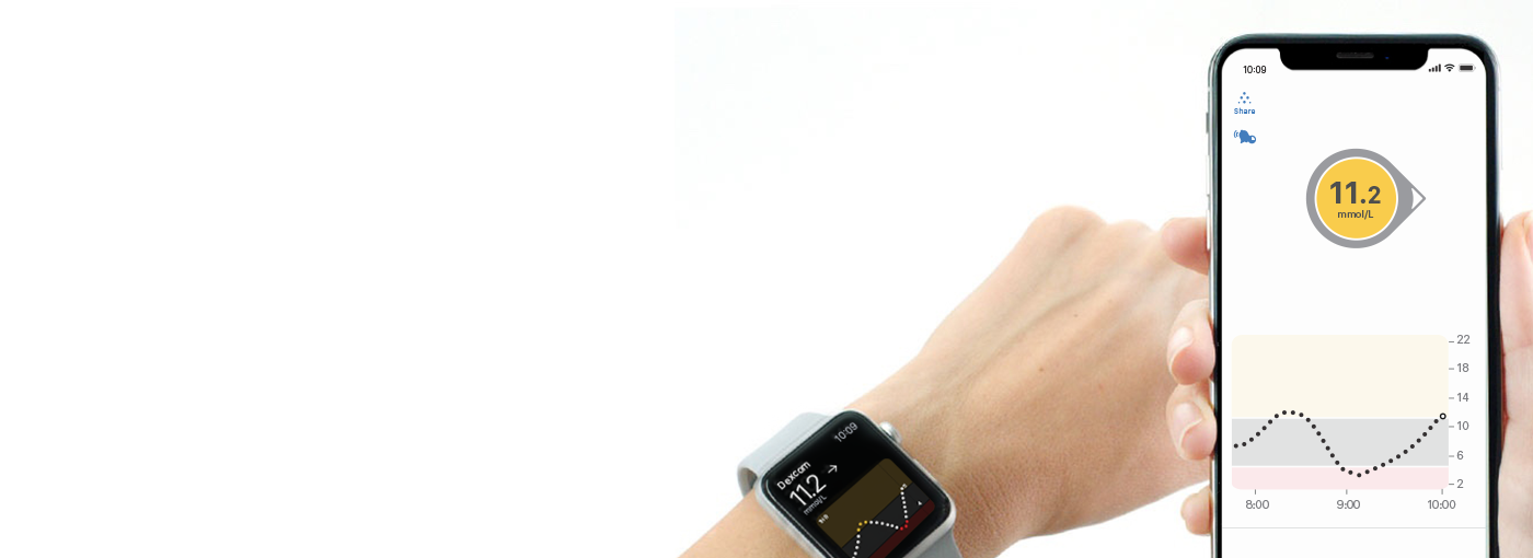 Okostelefon és karóra glükóz leolvasással